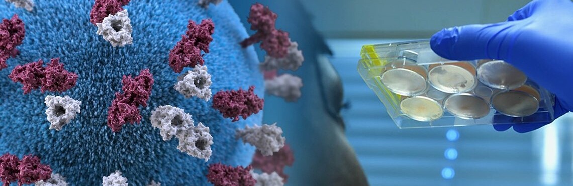  ������� ��� ���� ���� ����� ������ ������� 