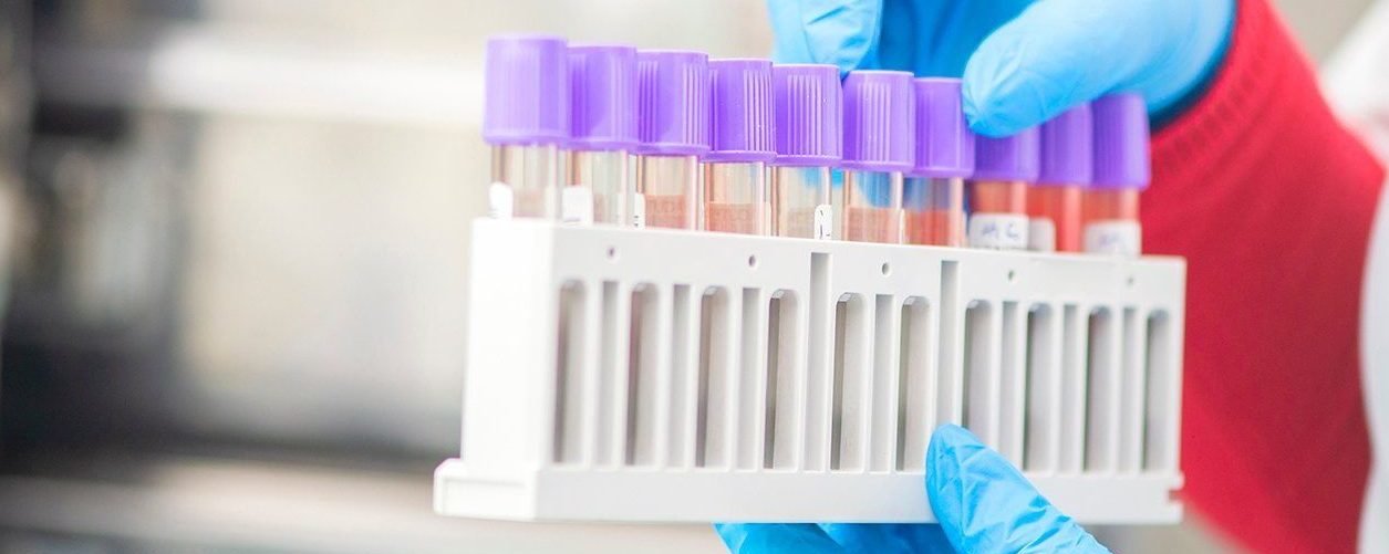  ���� ��� ����� ���� ������ ���������� covid-19 