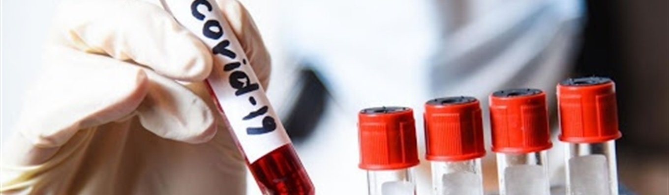  ���� ���� ���� ������ ������� ���� ������� 