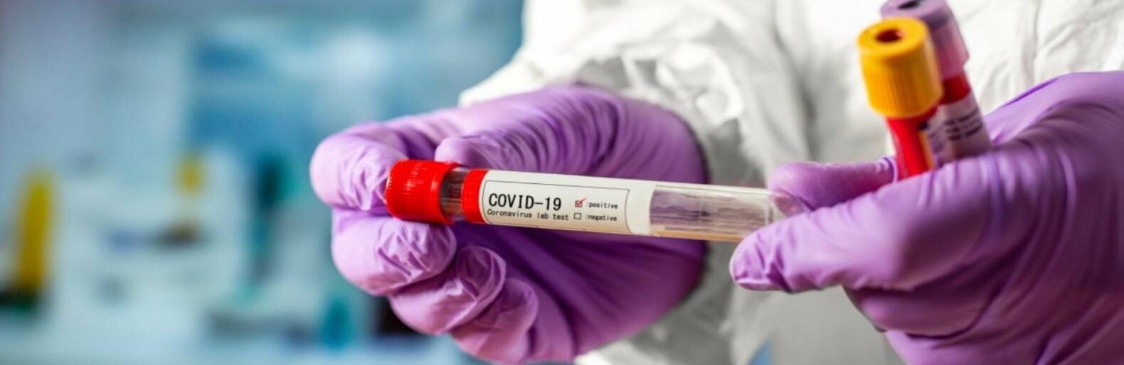 Ще 49 осіб з COVID-19 госпіталізували на Чернігівщині