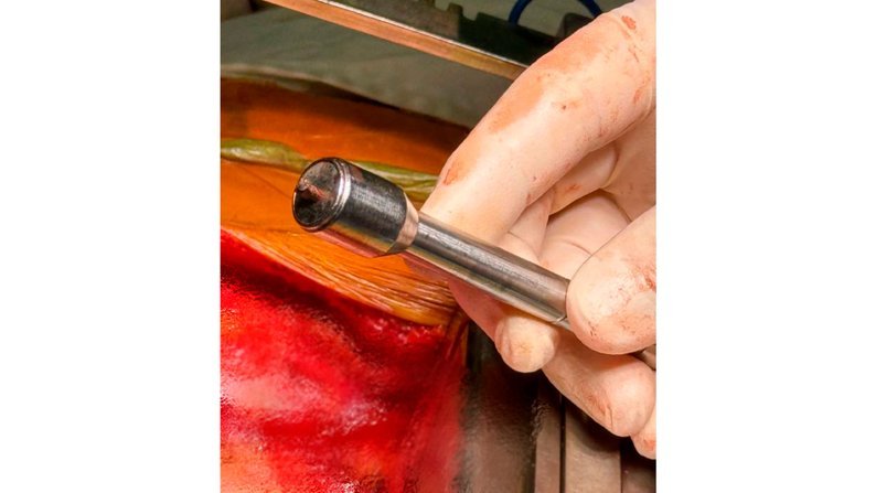 Осколок, який вилучили медики у чоловіка