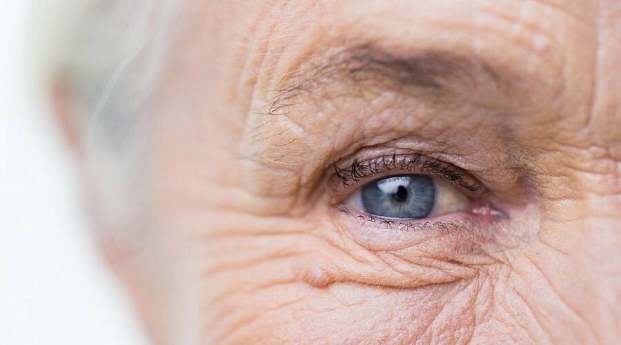 Лечение катаракты – мифы и реальность?
